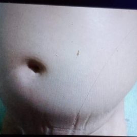 حالة الطفل / سيف